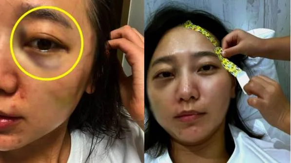 女星上賓館狂歡被抓包!老公氣炸拖進廁所剪髮洩憤 第 5 張